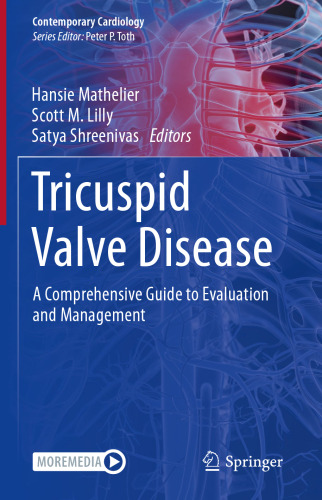 Tricuspid Valve Disease: A Comprehensive Guide to Evaluation and Management (Contemporary Cardiology)