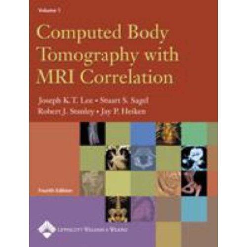 Computed Body Tomography with MRI Correlation