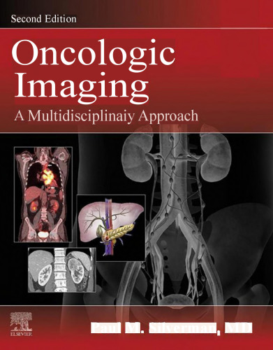 Oncologic Imaging: A Multidisciplinary Approach