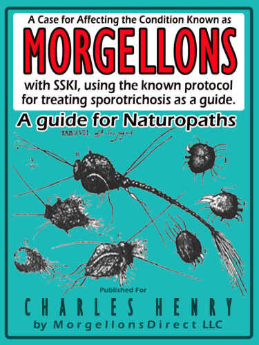 A Case for Affecting the Condition Known as: Morgellons: with SSKI (Super Saturated Potassium Iodide) B07CR9TPLL